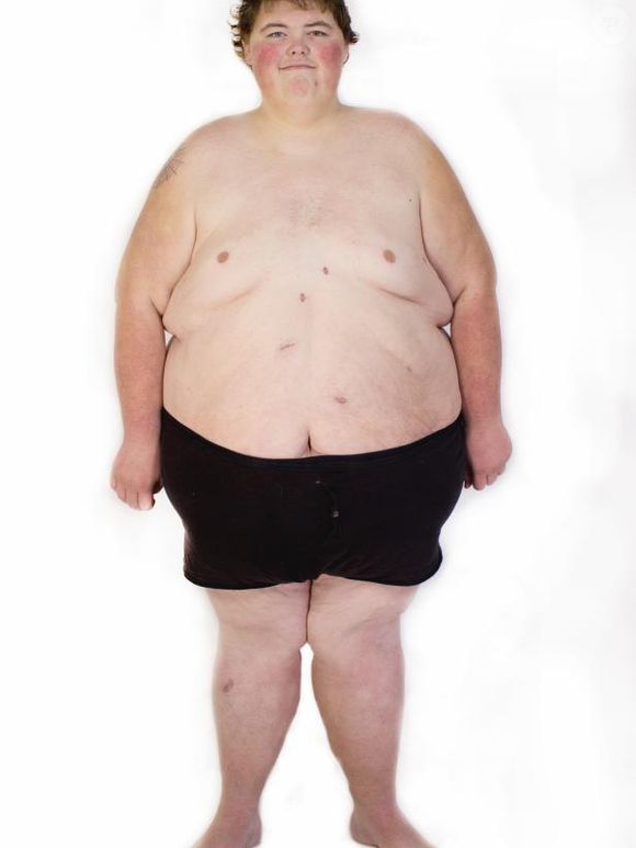 Garrett, por sua vez, conseguiu perder 122 quilos. Ele terminou o 'Quilos Mortais' pesando 154 kg