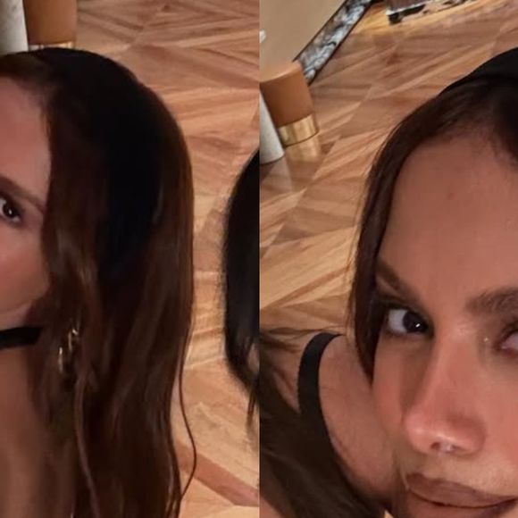 Antes e depois de Anitta é saudável? Especialista alerta para riscos à saúde após muitos procedimentos estéticos: 'Complicações vasculares'