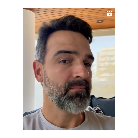 Tadeu Schmidt muda o visual e aposta em implante capilar antes do BBB 26