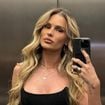 O que está por trás da beleza de Yasmin Brunet: modelo faz procedimento queridinho das famosas para deixar pele 'esticada' e super natural