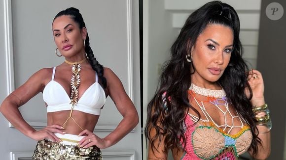 Antes e depois de Scheila Carvalho: dançarina optou por remover os preenchedores do rosto e passou a mostrar uma aparência mais natural