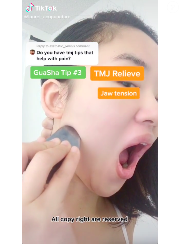 A terceira técnica é um gua sha para aliviar tensão de ATM trabalhando o músculo masseter do rosto