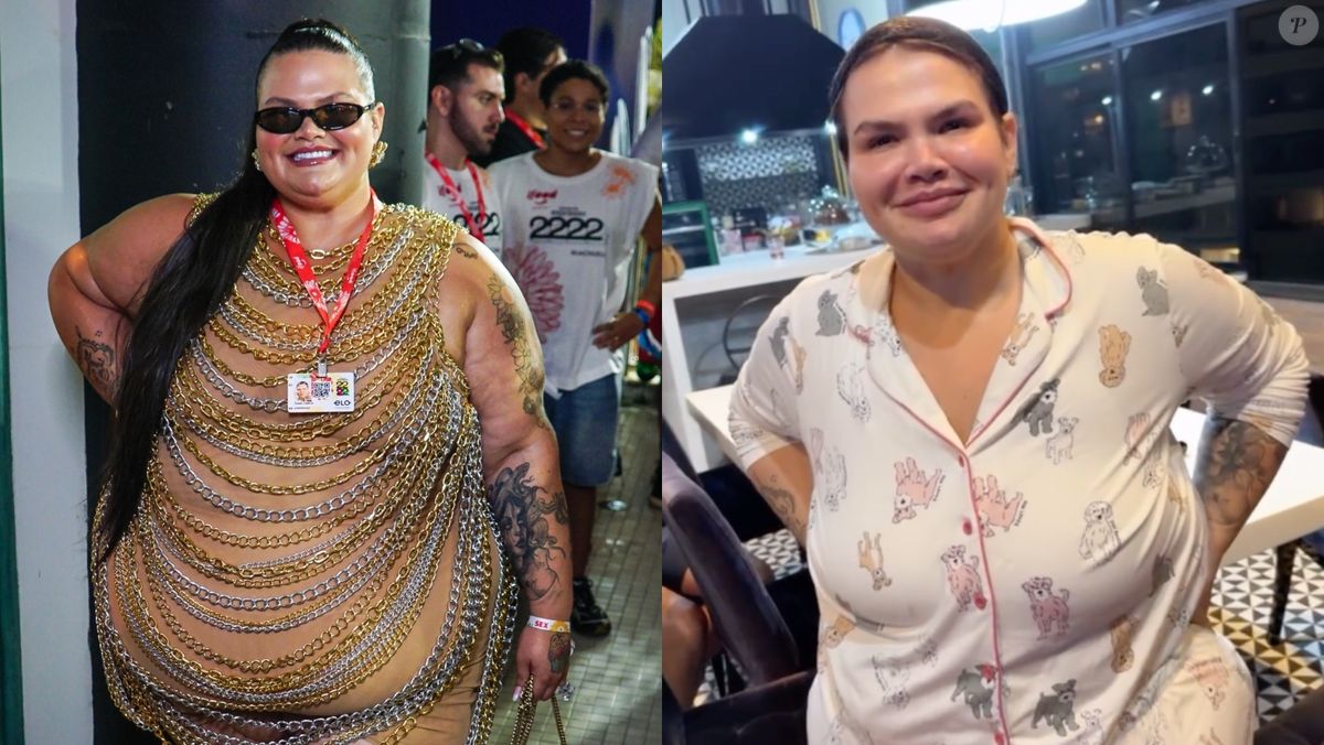 Foto: Thais Carla antes e depois: influenciadora choca ao mostrar novo ...