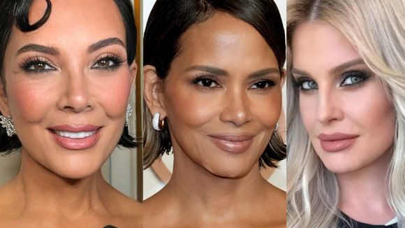 Kris Jenner, Anne Hathaway... e agora Kelly Osbourne! Antes e depois de 9 famosas +40 que chocaram a web com aparência rejuvenescida