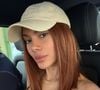 Anitta mostra nariz mais fino e olhos 'repuxados'