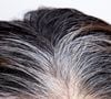 Receitinha caseira promete acabar com a queda de cabelo