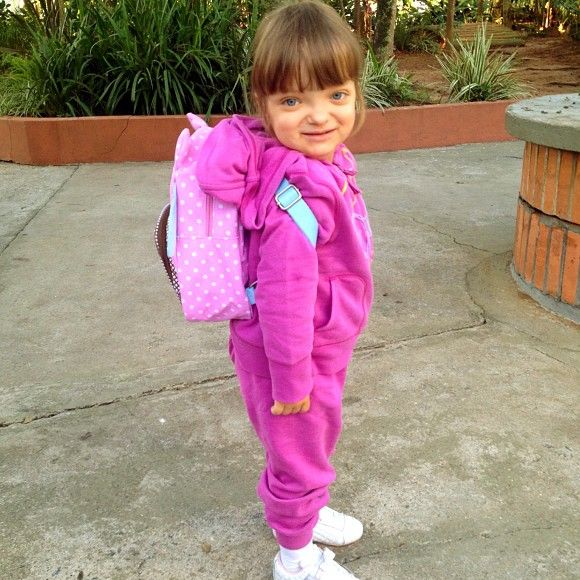 Condição de Rafa Justus é uma malformação no crânio que altera o desenvolvimento facial