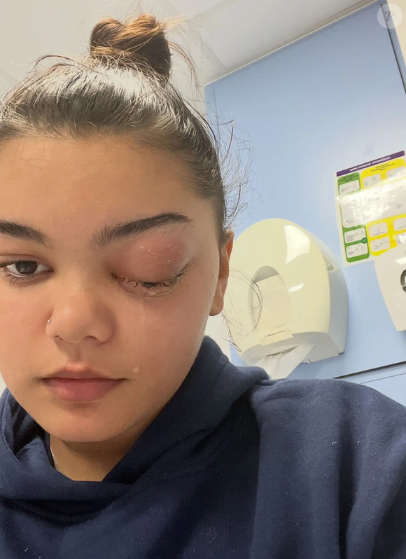 Sophie Bell, de Londres, contou ao The London Standard que tudo começou com dores de cabeça persistentes associadas a um vírus comum