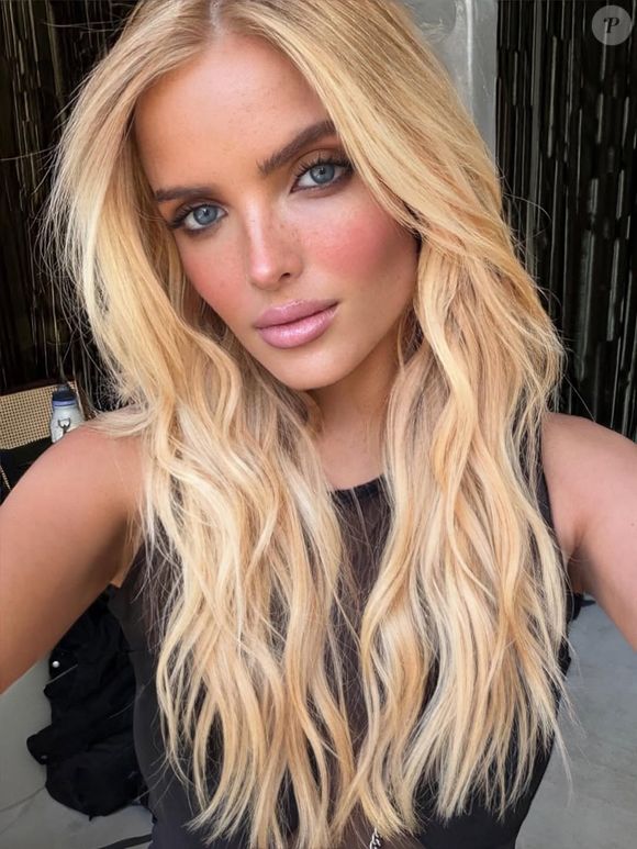 Giovanna Chaves em meio à polêmica sobre uso de Mounjaro para emagrecer