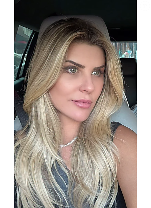 Íris Stefanelli mostrou o resultado dos procedimentos estéticos nos últimos dias