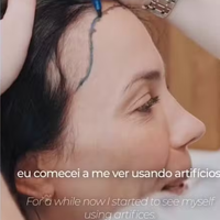 Com alopecia androgenética, Juliana Knust faz transplante capilar sem raspar cabelo; tricologista revela tratamentos que ajudam a recuperar os fios