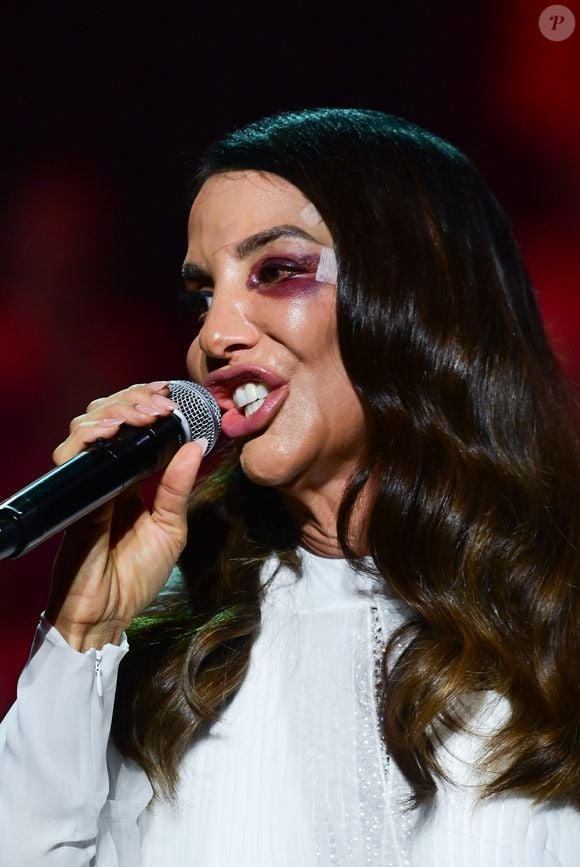 Ivete Sangalo ainda com curativo no rosto e olho bastante roxo fez show em SP