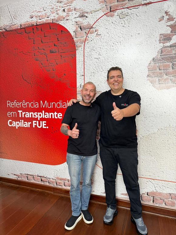 Rafael Ilha se junto aos famosos que realizaram transplante capilar