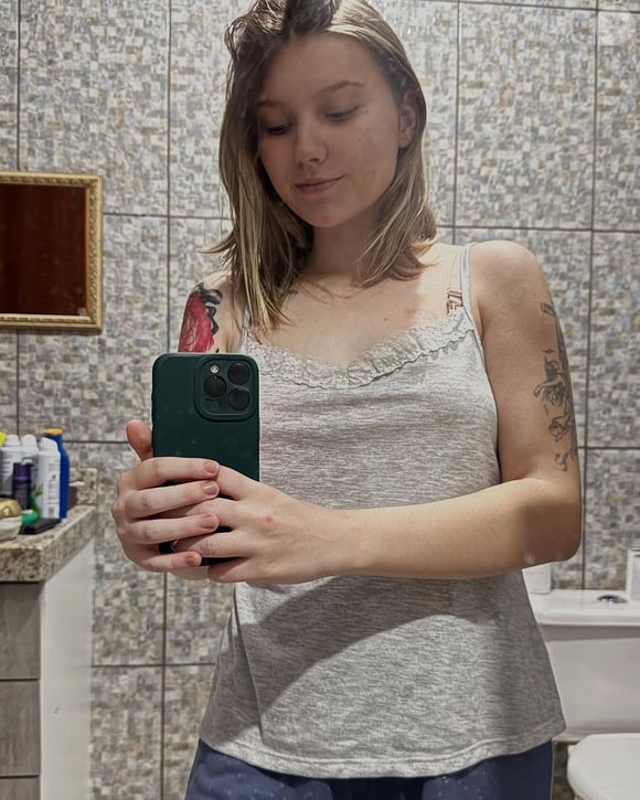 Isabel Veloso enfrenta um tipo de câncer desde os 15 anos: 'Eu tinha no direito e agora estou com nódulos no esquerdo também'