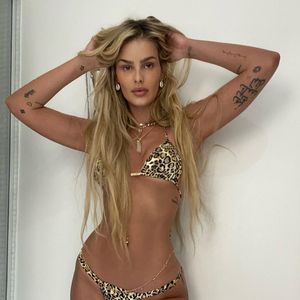 O que poucos sabiam era que Yasmin Brunet tinha questões seríssimas com as pernas