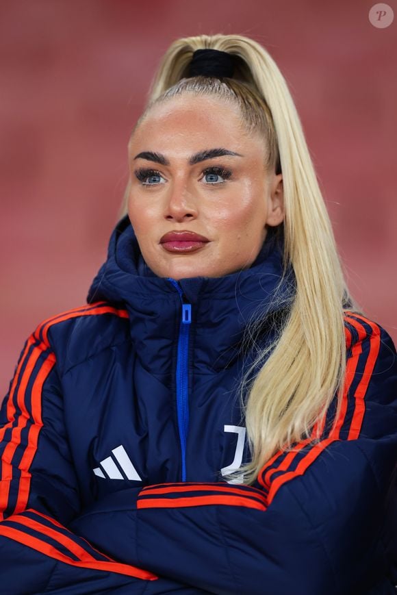 Alisha Lehmann pode ter feito procedimentos estéticos, mas nunca os comentou