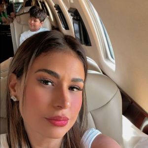 Simone Mendes retirou o excesso de pele dos olhos sem precisar fazer uma blefaroplastia