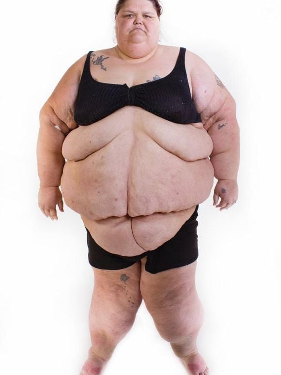 Robin McKinley, tinha 40 anos quando gravou o reality show e pesava 294 kg sozinha
