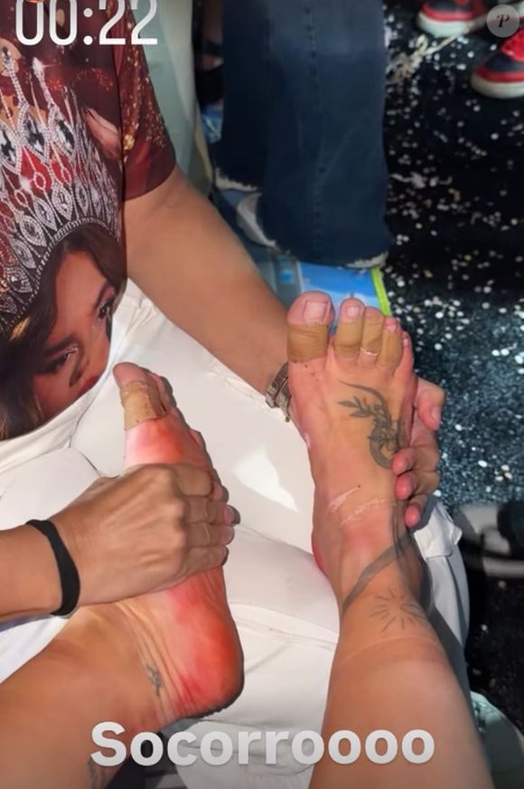 Virgínia Fonseca mostrou os pés muito machucados após o ensaio