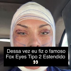 Andressa Urach fez um procedimento para deixar os olhos puxados