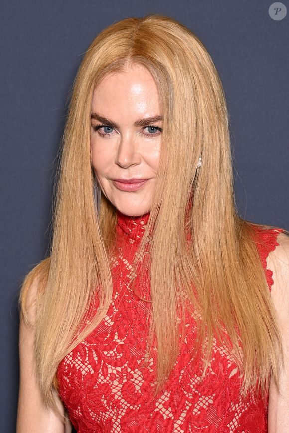 Antes e depois de Nicole Kidman é impressionante! Preferem ela cacheada ou lisa?