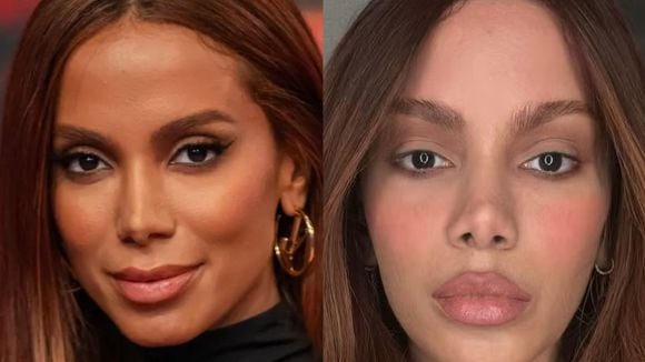 Lifting endoscópio e lifting labial: cirurgião plástico lista 4 indícios de que Anitta passou pelos 2 procedimentos estéticos