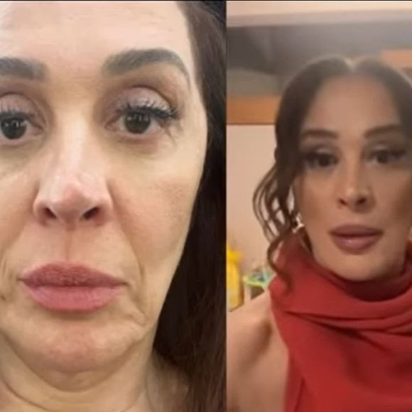 Antes e depois do rosto de Claudia Raia foi revelado pela atriz após os procedimentos estéticos com fios de colágeno