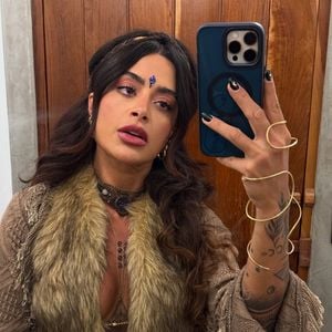 Aline Campos também passou por um transplante de sobrancelhas em 2024