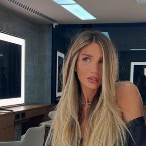 No rosto, Aline Gotschalg garante ter feito laser fotona e aplicações de botox