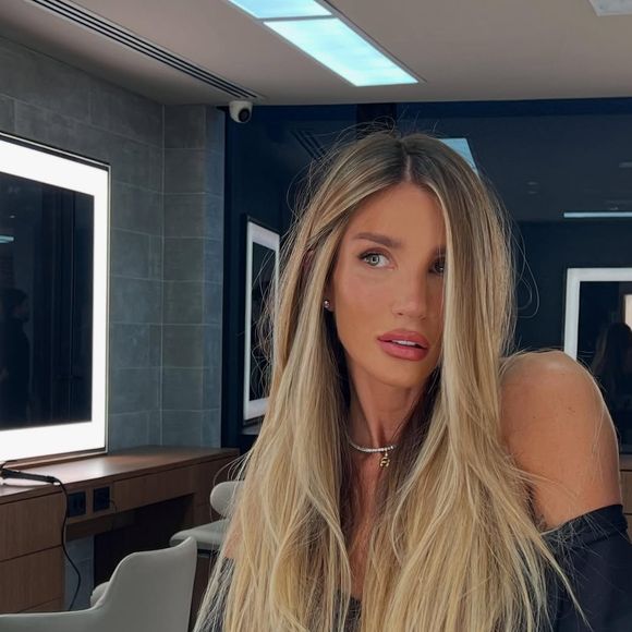 No rosto, Aline Gotschalg garante ter feito laser fotona e aplicações de botox