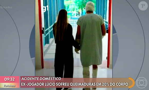 Ex-jogador Lúcio sofreu grave acidente que deixou queimaduras por várias partes de seu corpo.