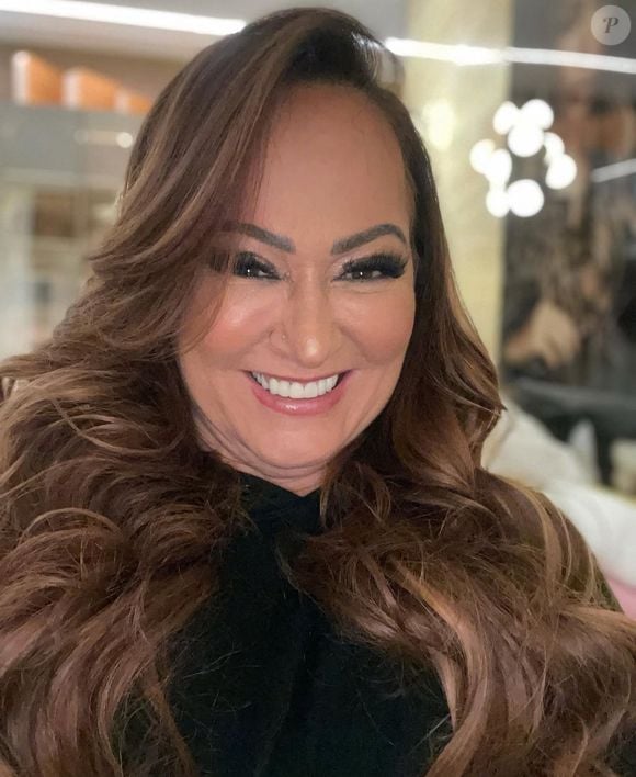 Nadine Gonçalves também já fez harmonização facial e garantiu um visual renovado