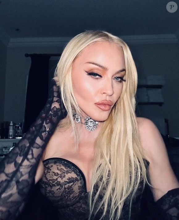 Antes e depois de Madonna em 50 fotos: lifting, rinoplastia e preenchimento estão na lista de intervenções suspeitas entre fãs e especialistas