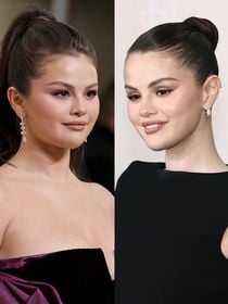 Antes e depois de Selena Gomez em 40 fotos: cirurgião plástico aponta rinoplastia, lifting e mais procedimentos, mas a cantora só admitiu um até hoje