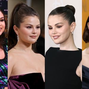 Antes e depois Selena Gomez em 40 fotos: cirurgião plástico aponta rinoplastia, lifting e mais procedimentos, mas a cantora só admitiu um até hoje