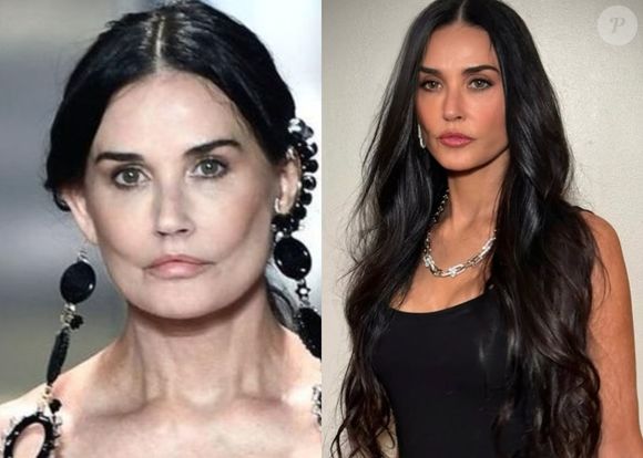 A atriz Demi Moore retornou aos holofotes com o filme "The Substance", exibido no Festival de Cannes, onde interpreta uma personagem que busca rejuvenescer. Sua performance foi aclamada, e sua aparência jovial chamou a atenção do público e da crítica.