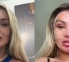 Andressa Urach já passou por diversos procedimentos estéticos