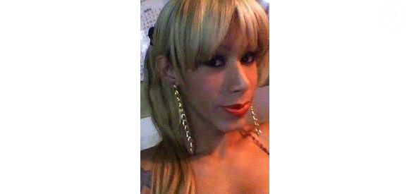 Juju do Pix revelou rosto antes de ter óleo mineral aplicado em clínica clandestina, acreditando se tratar de silicone