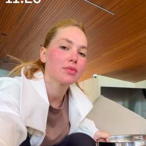 A estimativa é que o resultado final do rosto de Virgínia leve alguns meses para aparecer