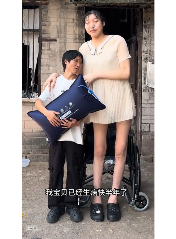 Xiao Yue morreu após quadro de insuficiência renal e hiperglicemia grave