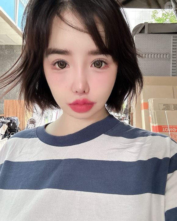 Segundo alguns fãs, Park Bom teria sido diagnosticada com uma doença inflamatória linfática