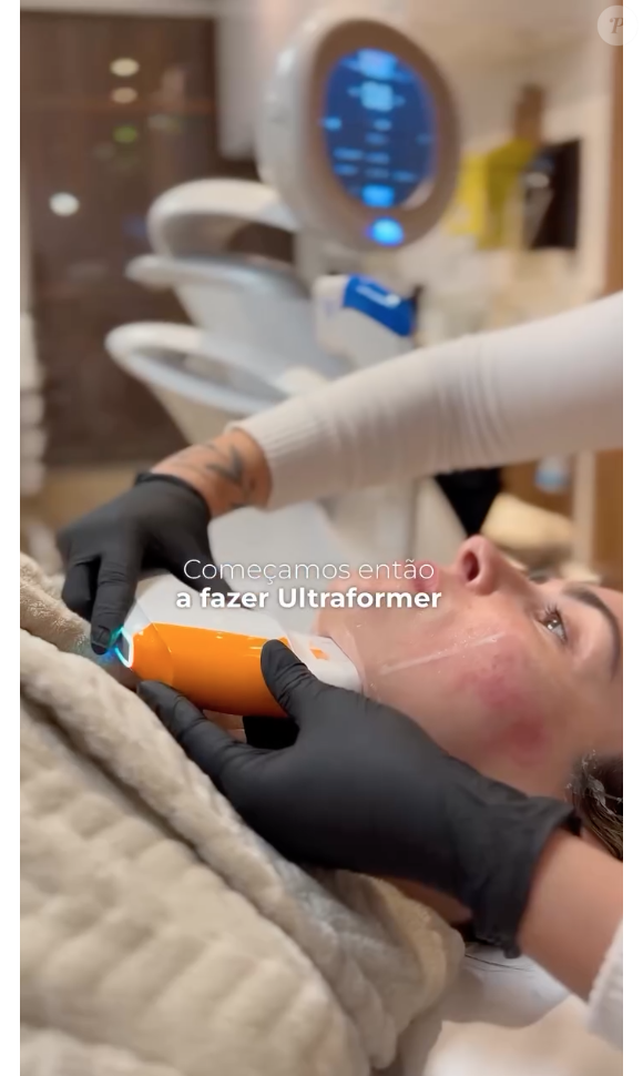 Ana Paula Renault usa técnicas revolucionárias e pouco invasivas, como o Ultraformer MPT