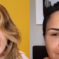Gente? Ana Paula Renault surge irreconhecível e inchada em vídeo antigo após procedimento estético; antes e depois viraliza: 'Pelo visto funcionou'