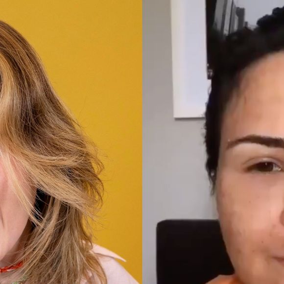 Ana Paula Renault surge irreconhecível e inchada em vídeo antigo após procedimento estético; antes e depois viraliza: 'Pelo visto funcionou'