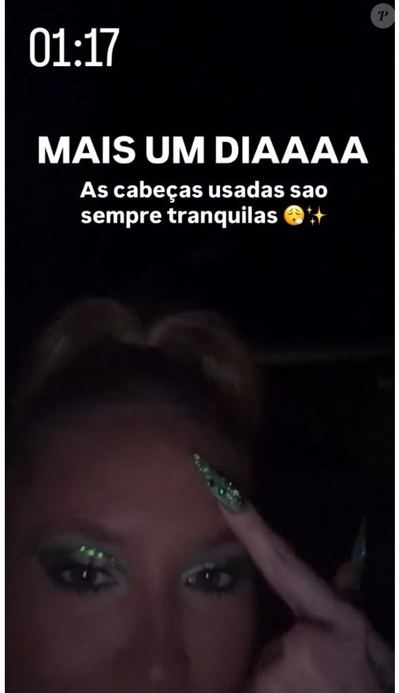 Virginia Fonseca no carnaval 2026: influencer ficou com machucado na cabeça por conta do adereço do ensaio técnico da Grande Rio, em 1º de fevereiro de 2026
