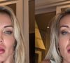 Estado de saúde de Andressa Urach: após sofrer surto e ficar 5 dias de cama, influenciadora faz relato sobre saúde mental: 'Passei por situações...'