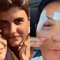 3 palavras simples, mas impactantes: o recado que Ivete Sangalo recebeu do filho, Marcelo, após desmaio, ferimentos no rosto e internação