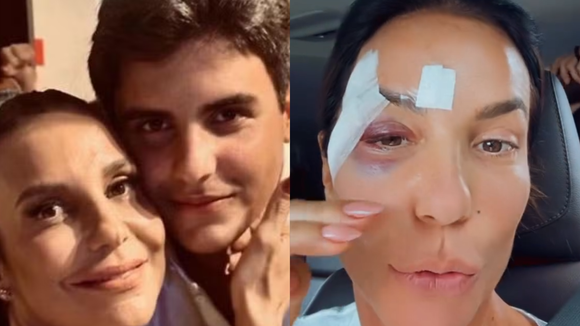 3 palavras simples, mas impactantes: o recado que Ivete Sangalo recebeu do filho, Marcelo, após desmaio, ferimentos no rosto e internação