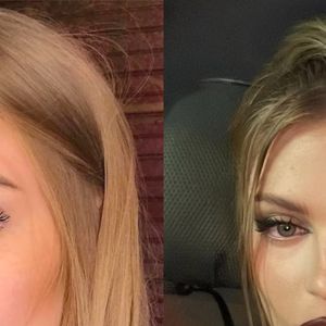 Antes e depois de Luísa Sonza: embora garanta só ter feito preenchimento labial, cantora é outra pessoa hoje em dia