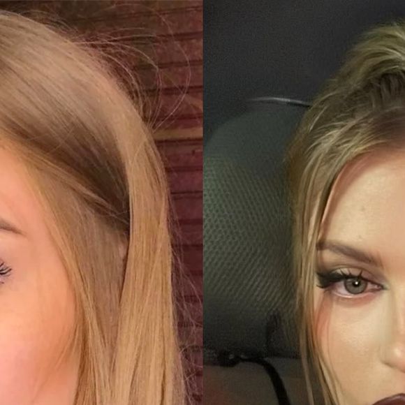 Antes e depois de Luísa Sonza: embora garanta só ter feito preenchimento labial, cantora é outra pessoa hoje em dia